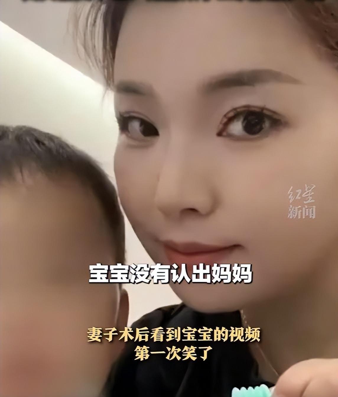 烧伤妈妈后续！丈夫崩溃透露：她状态很差，不想治了想回家。