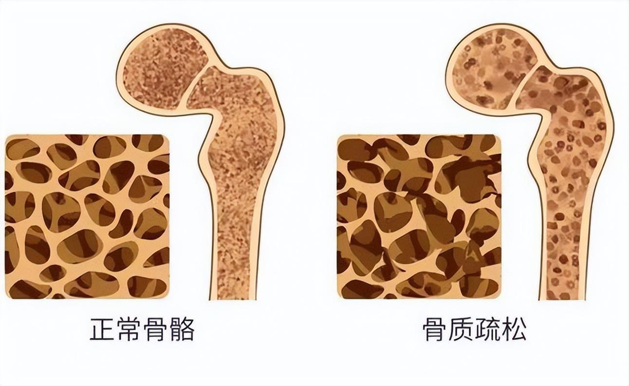 研究发现：一旦吃上降压药，3件事就别做了，不要害了自己？