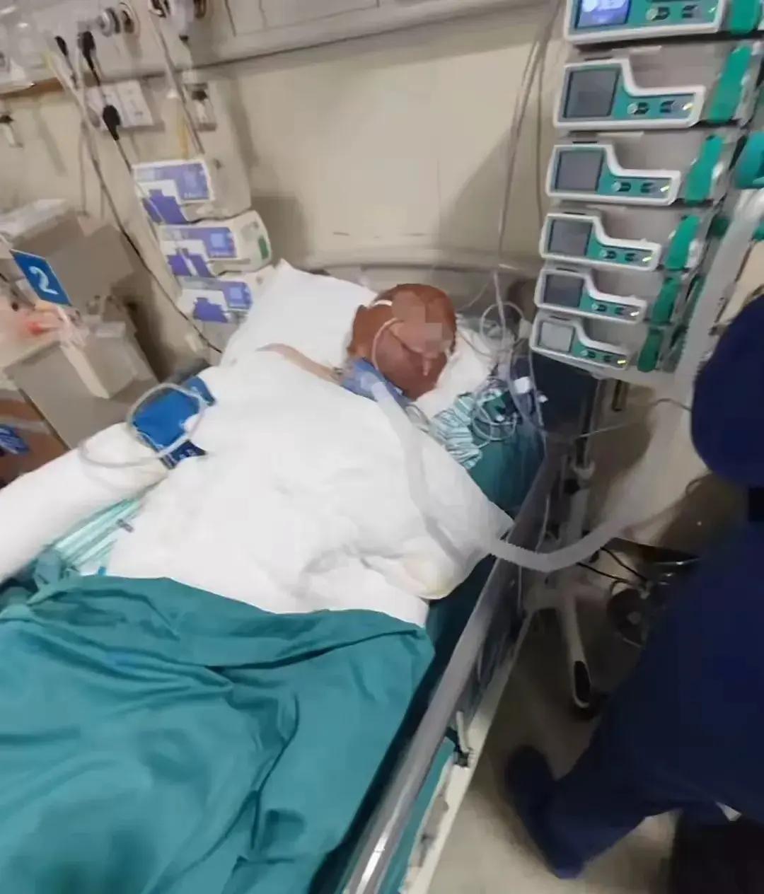 烧伤妈妈后续！丈夫崩溃透露：她状态很差，不想治了想回家。